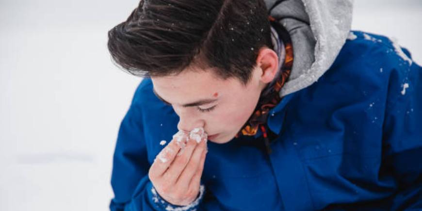 What Causes Nosebleeds? And How Can You Prevent Them?